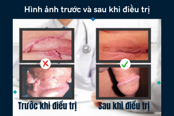 bxh (48).png
