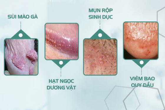 mun-thit-vung-kin-nam-1.jpg