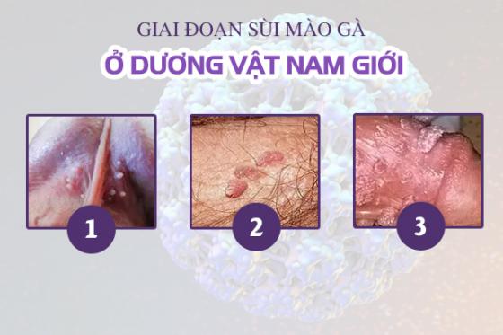 mun-thit-vung-kin-nam.jpg